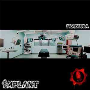 IMPLΛNT - Fraktura download flac