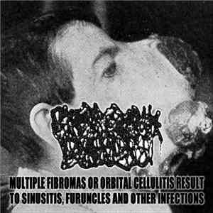 Chernobirth Defects - Multiple Fibromas Or Orbital Cellulitis Result To Sinusitis, Furuncles And Other Infections download flac