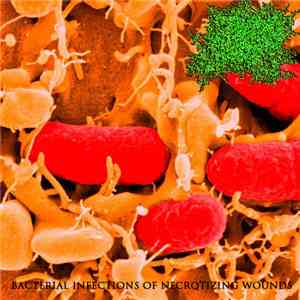DxTxS - Bacterial Infections Of Necrotizing Wounds download flac