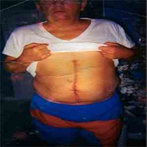 Patrick Emm - Sick Days download flac