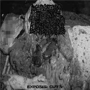 Ascaris Lumbricoides - Exposed Guts download flac