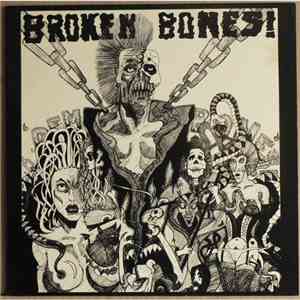 Broken Bones! - Dem Bones download flac