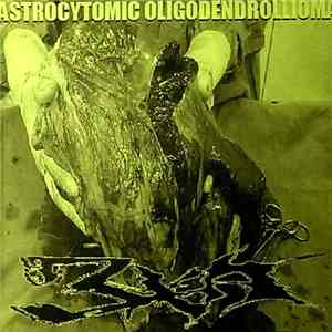 3XA - Astrocytomic Oligodendrollioma download flac