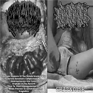 Hypoprothrombinemia, Anal Cake - Traumatic Rupture Of The Female Urethra With Severe Dysentery Complicated By Gastroenteritis And Cystic Eruption In The Rectum Due To Fatal Syphogiideimea In The Whole Process Of Gestation In The Pregnancy / Shitnoise download flac