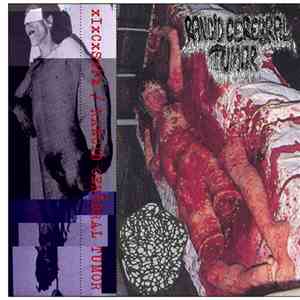 Rancid Cerebral Tumor / xIxCxSxPx - Mummified And Dissolved Corpses download flac