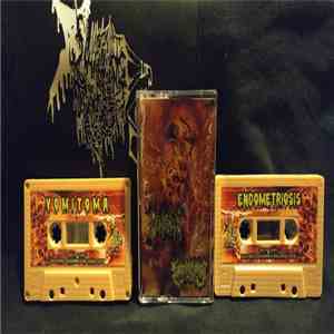 Vomitoma / Endometriosis - Split download flac