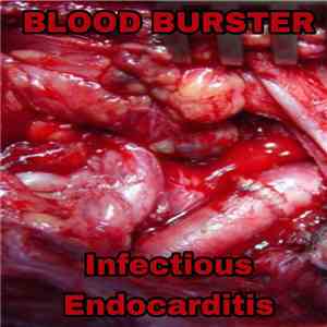 Blood Burster - Infectious Endocarditis download flac